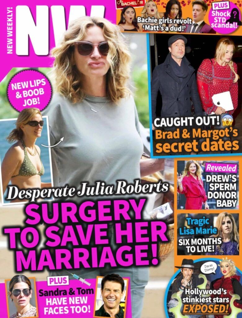 ¿Julia Roberts se sometió a una cirugía plástica para salvar su matrimonio?