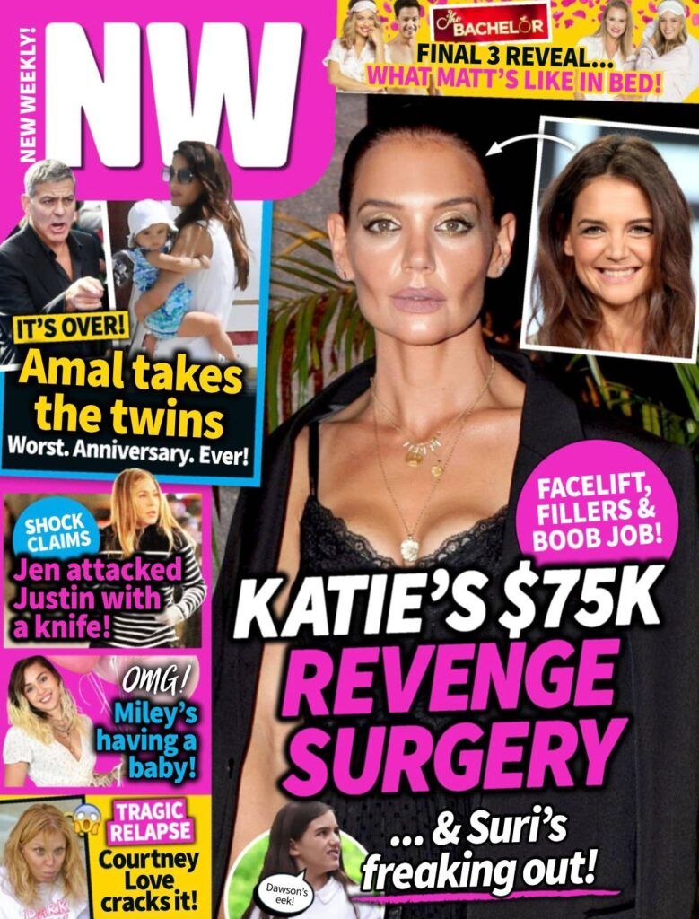 ¿Katie Holmes gastó $ 75,000 en cirugía plástica después de la separación de Jamie Foxx?