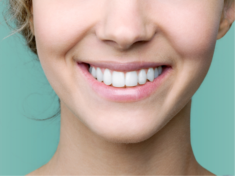 Vakkert smil av ung kvinne med sunne hvite tenner